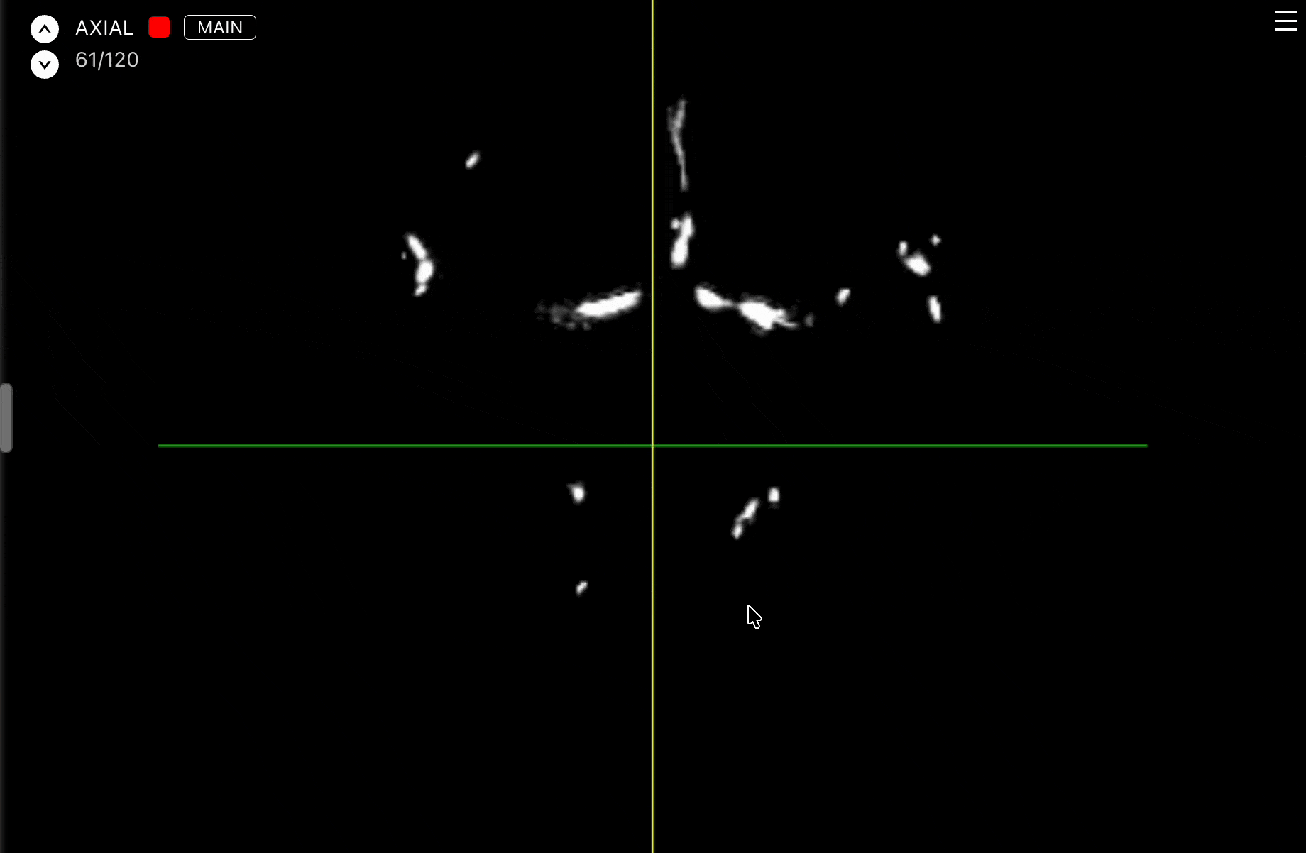 Moving planes with crosshair lines in the 3D Medical labeling editor