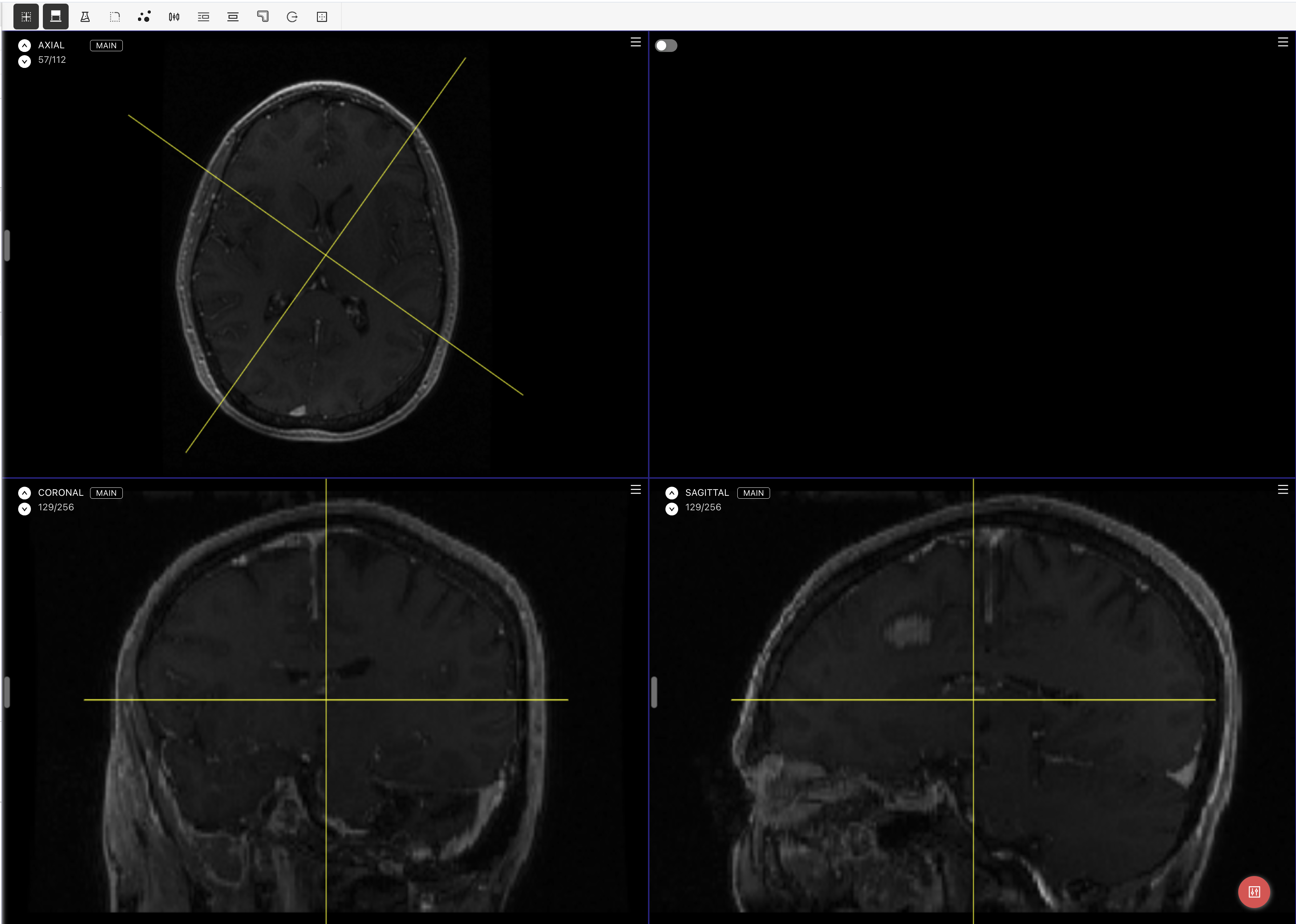 Medical editor Reformat view for NRRD assets